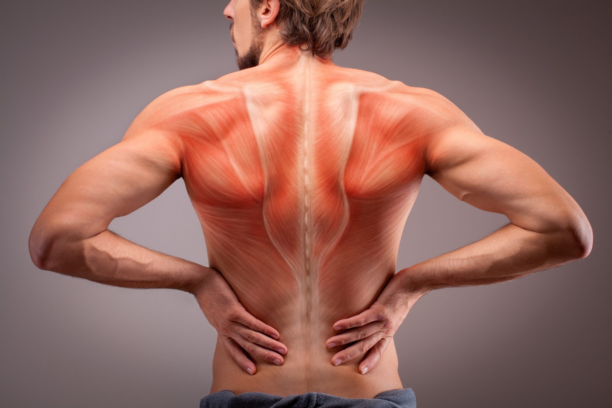 fibromyalgie